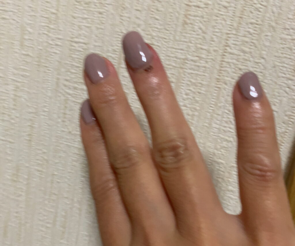 そのお悩み皮膚科ではなく ネイルで解消できるかも ニコルネイル Nail Nicol サロン スクール