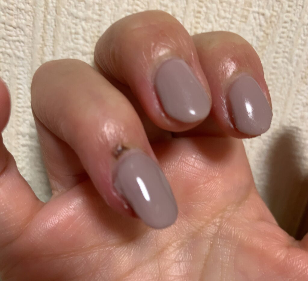 そのお悩み皮膚科ではなく ネイルで解消できるかも ニコルネイル Nail Nicol サロン スクール